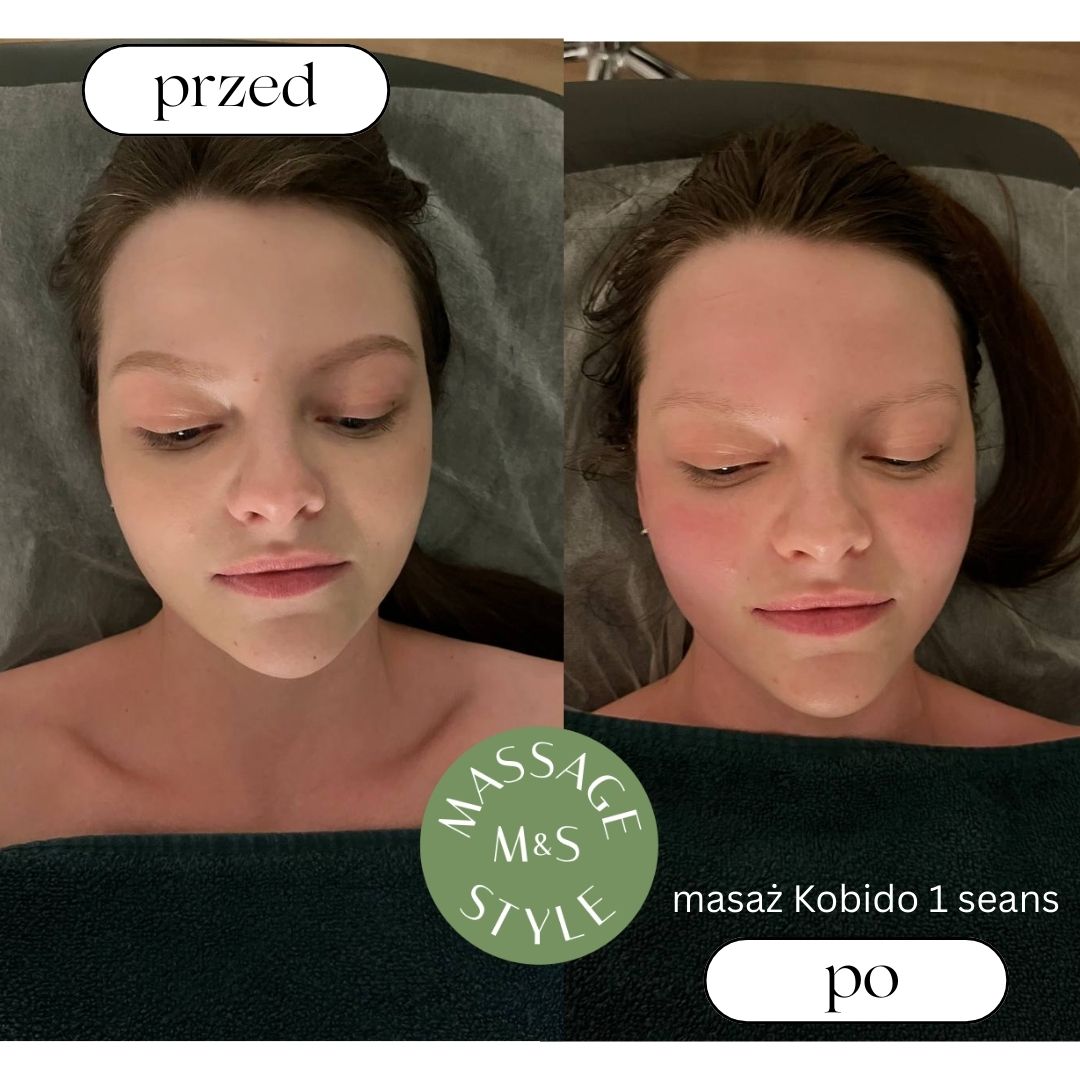 Masaż Kobido — przed i po, 2