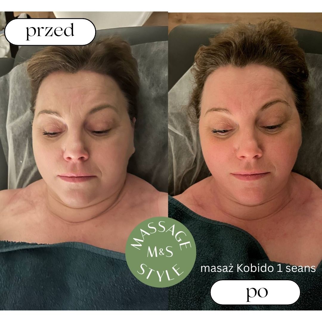 Masaż Kobido — przed i po, 1